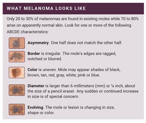 how to test for melanoma